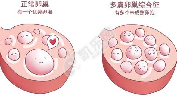 三代试管包男孩费用,上海多学科专家合力助短肠综合征患者成为双胞胎妈妈